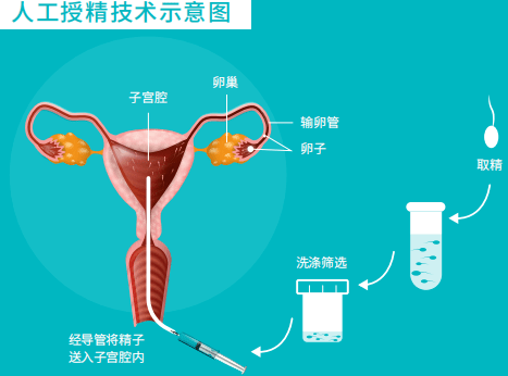 重庆有供卵中心吗？重庆哪家医院能做供卵试管？